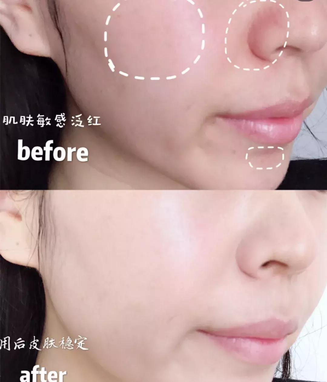 在家可以做脸部spa吗,玻尿酸深层按摩补水护理