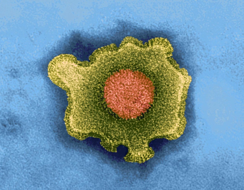 疱疹有可能长一颗吗,疱疹长满全身就会死吗