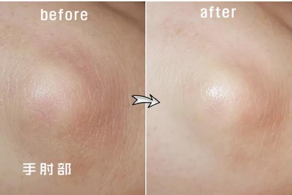 杨幂直播露白皙脚踝惹人羡！我用李佳琦推的足部喷雾，搓出少女足