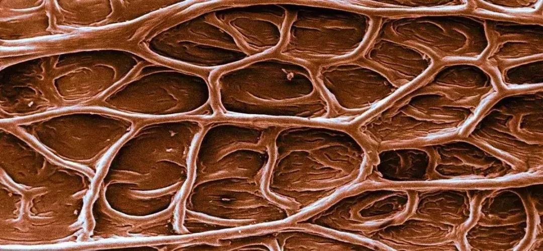 肠息肉胆囊息肉怎么治,肠息肉胆息肉胃息肉吃什么胶囊