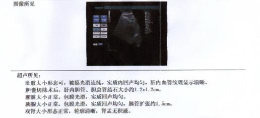 安徽中西医结合医院治疗结石,北京中医谁能治胆结石