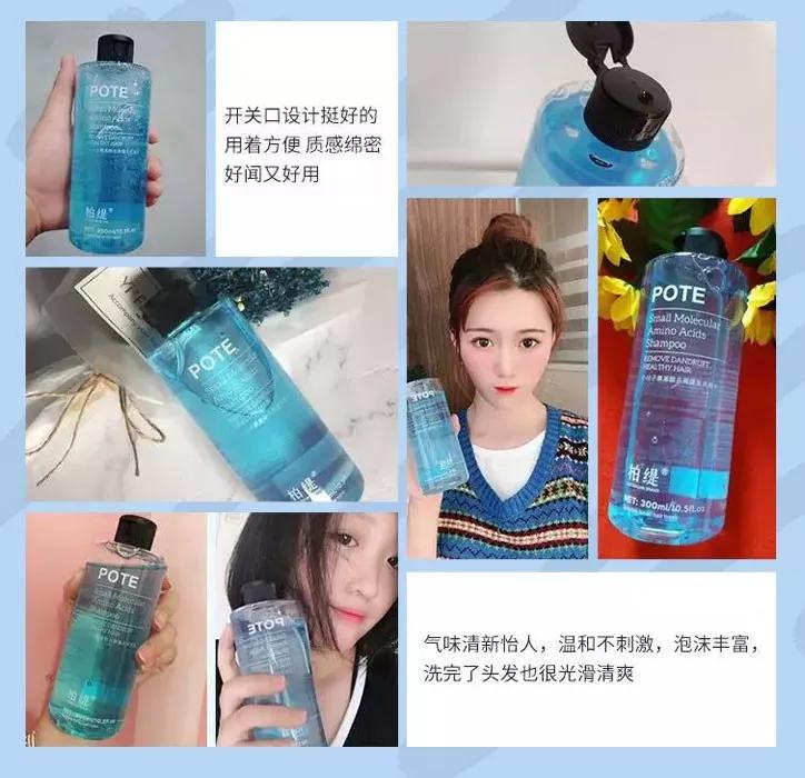 天天散着头发容易脱发吗,头发油了特别容易脱发