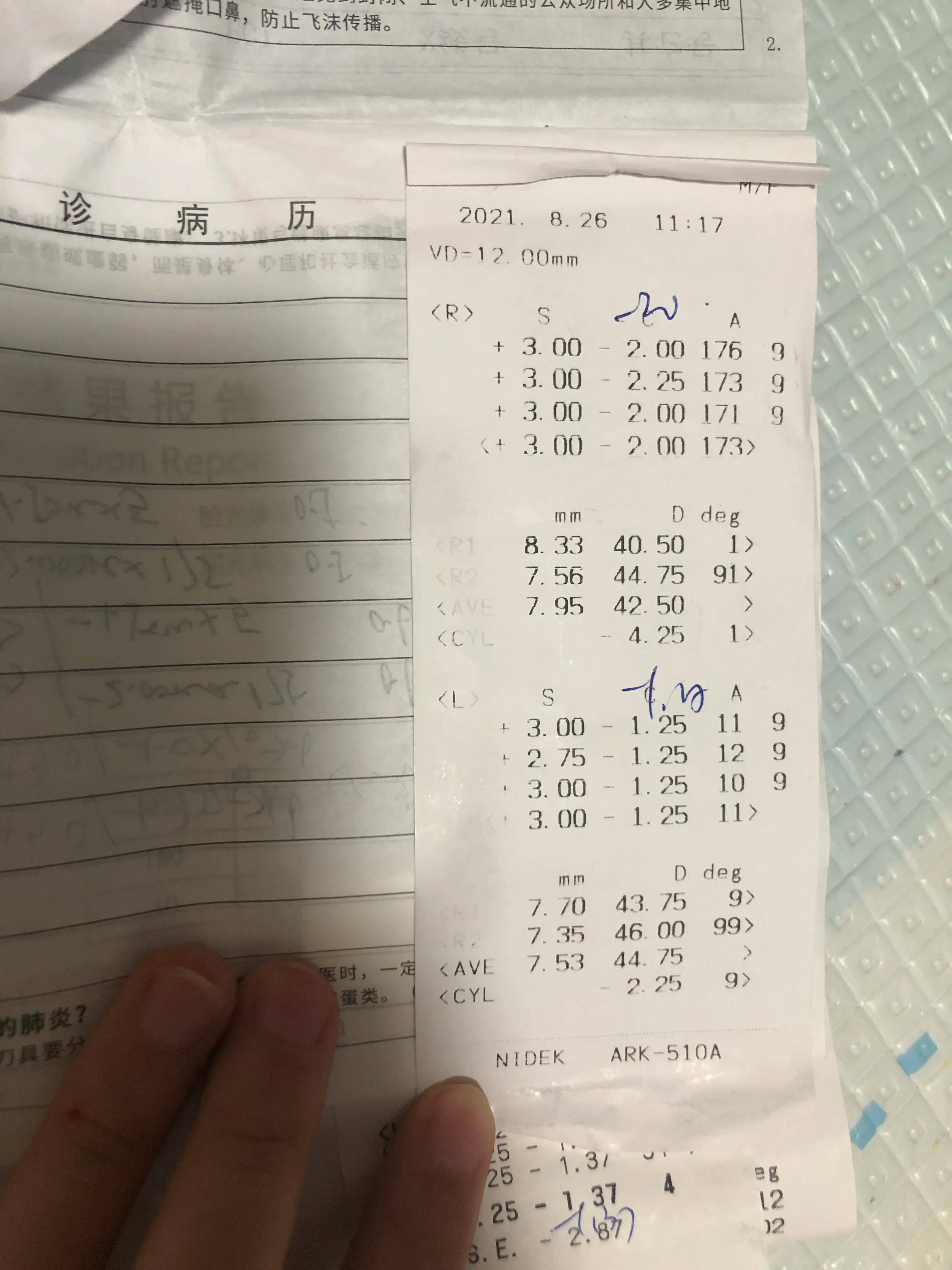 幼儿园体检散光3.0严重吗,3岁体检散光