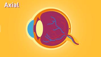 古代人近视如果没有眼镜怎么办,古代人近视时是怎样的