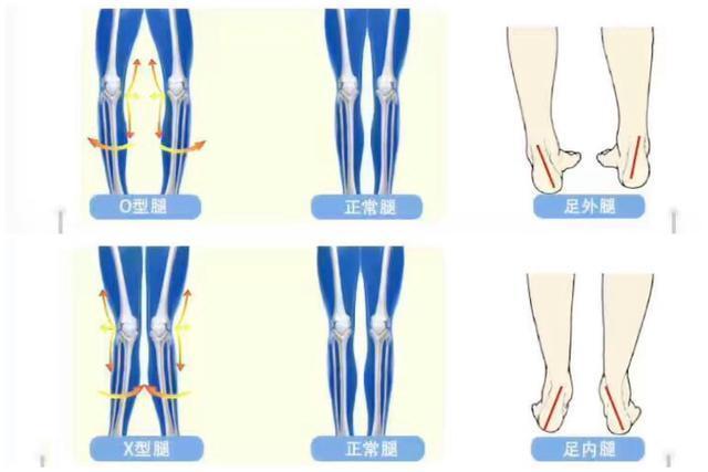 腿型不好看怎么穿搭,小短腿腿粗怎样穿搭