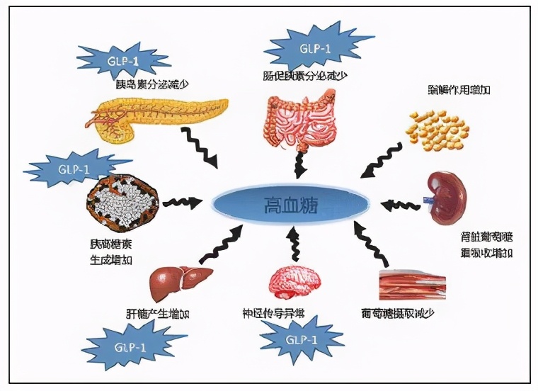2型糖尿病心血管危险分级,2类糖尿病如何预防