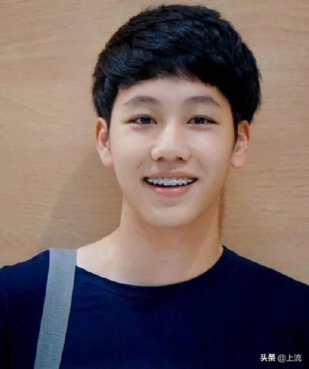 泰国流行戴牙套,泰国最近很火的牙套