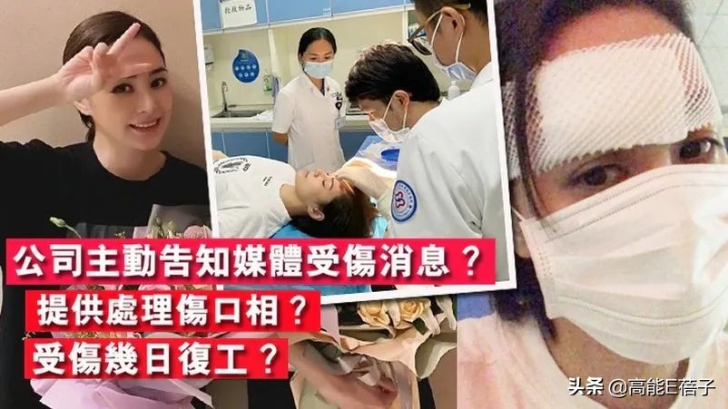 阿娇额头伤口恢复过程,阿娇晒伤口恢复照