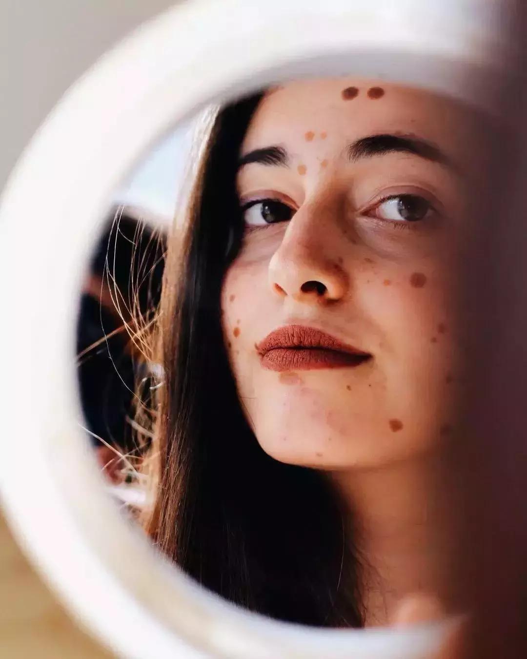 全身黑斑被骂“斑点狗”，身高160的她却成为最美超模…