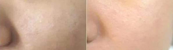 最好用的大牌定妆粉推荐,热门平价定妆粉