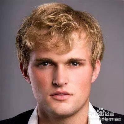 发际线太高怎么办一招解决,有人说我发际线高怎么办