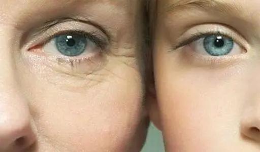 眼部皮肤老化怎么改善,眼部肌肤衰老怎么保养