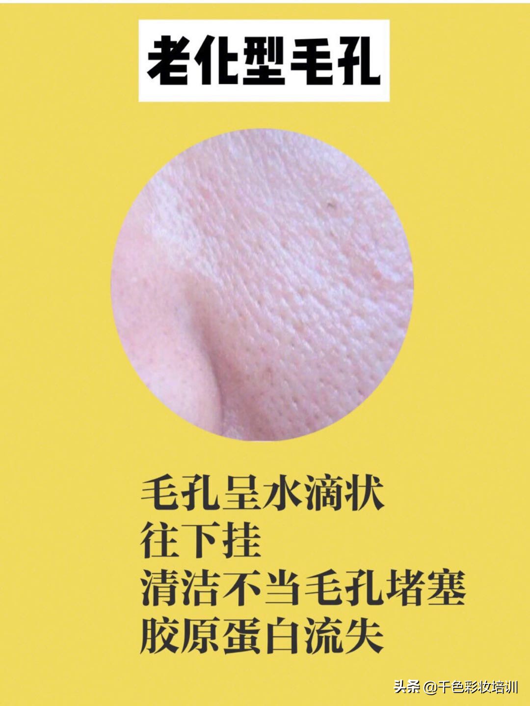 毛孔粗大怎么办怎么有效收缩毛孔,毛孔粗大怎么办教你几招收缩毛孔