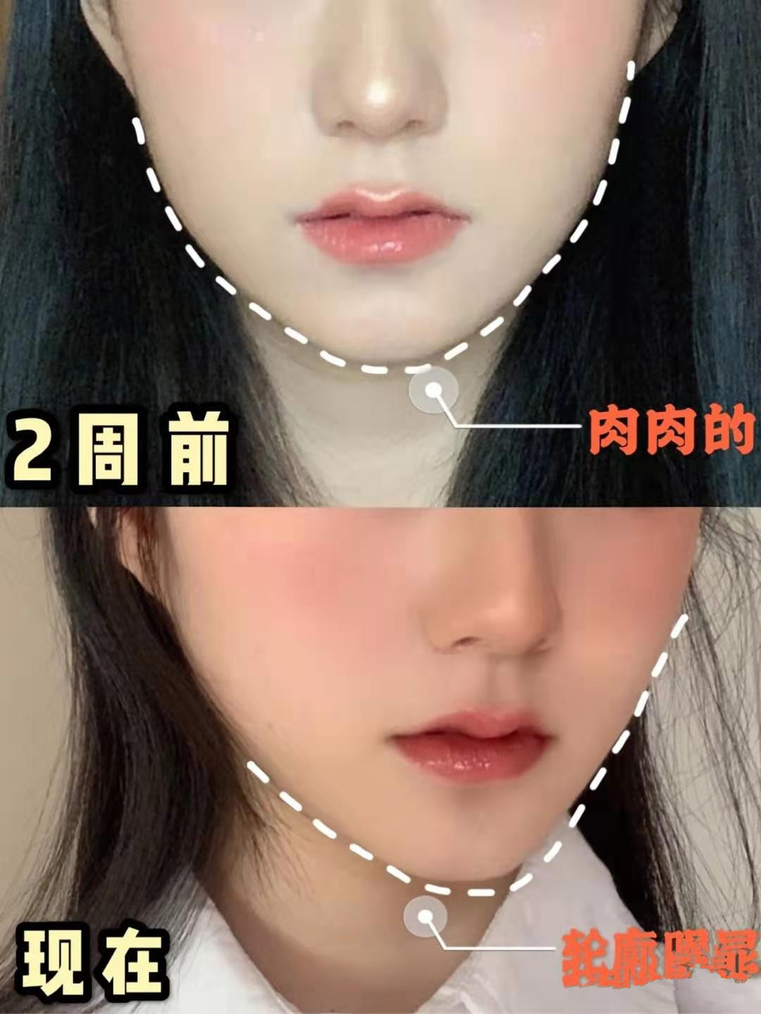 胖脸怎么变瘦得最快,胖脸变瘦教程