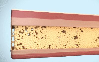 如何瘦双下巴和婴儿肥,小孩怎么快速减掉双下巴