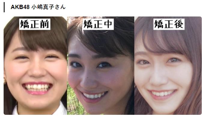 牙齿不整齐的日本女孩,日本人牙齿不齐怎么回事