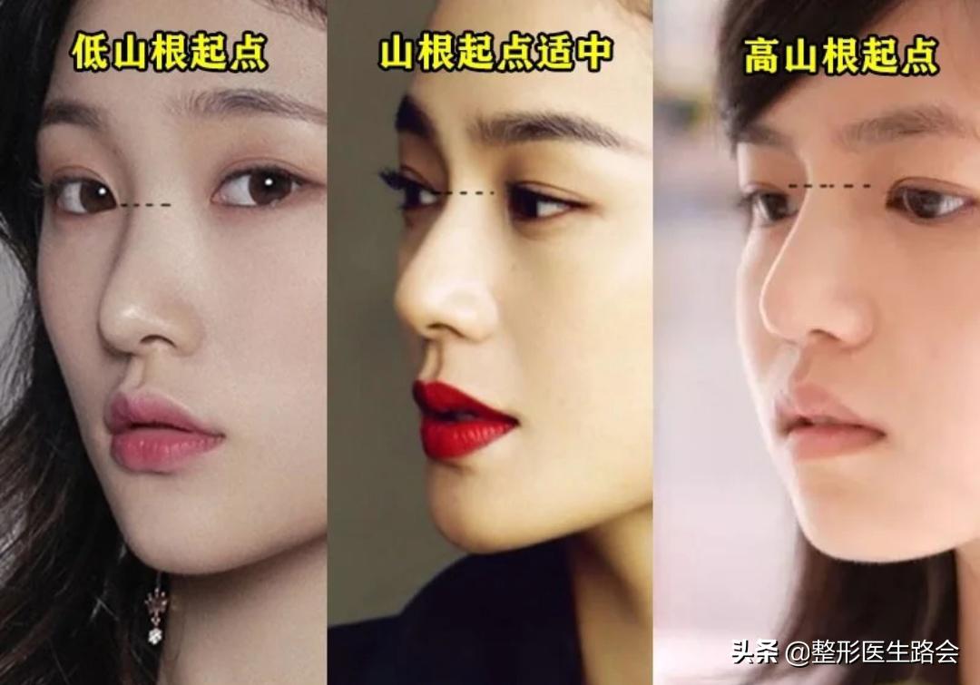 直鼻微翘怎么整,直鼻微翘怎么做出来自然又好看