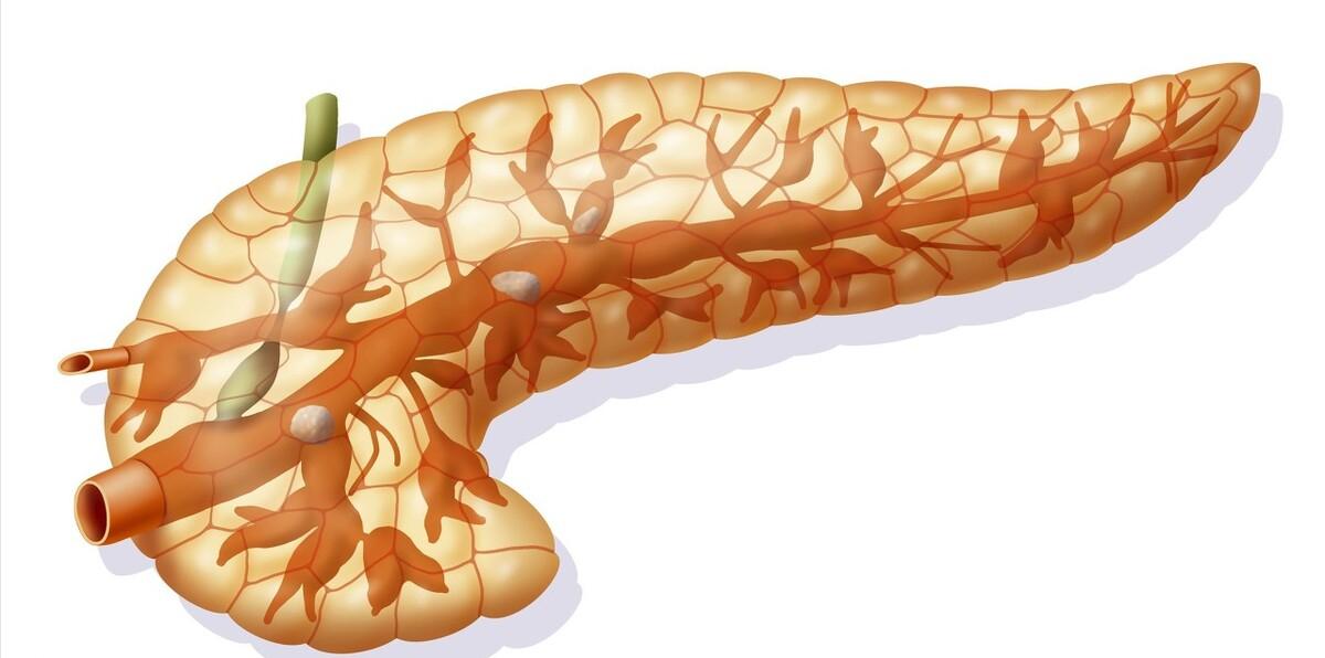中国治疗胰腺癌有哪些方法,中国临床肿瘤学会胰腺癌诊疗指南