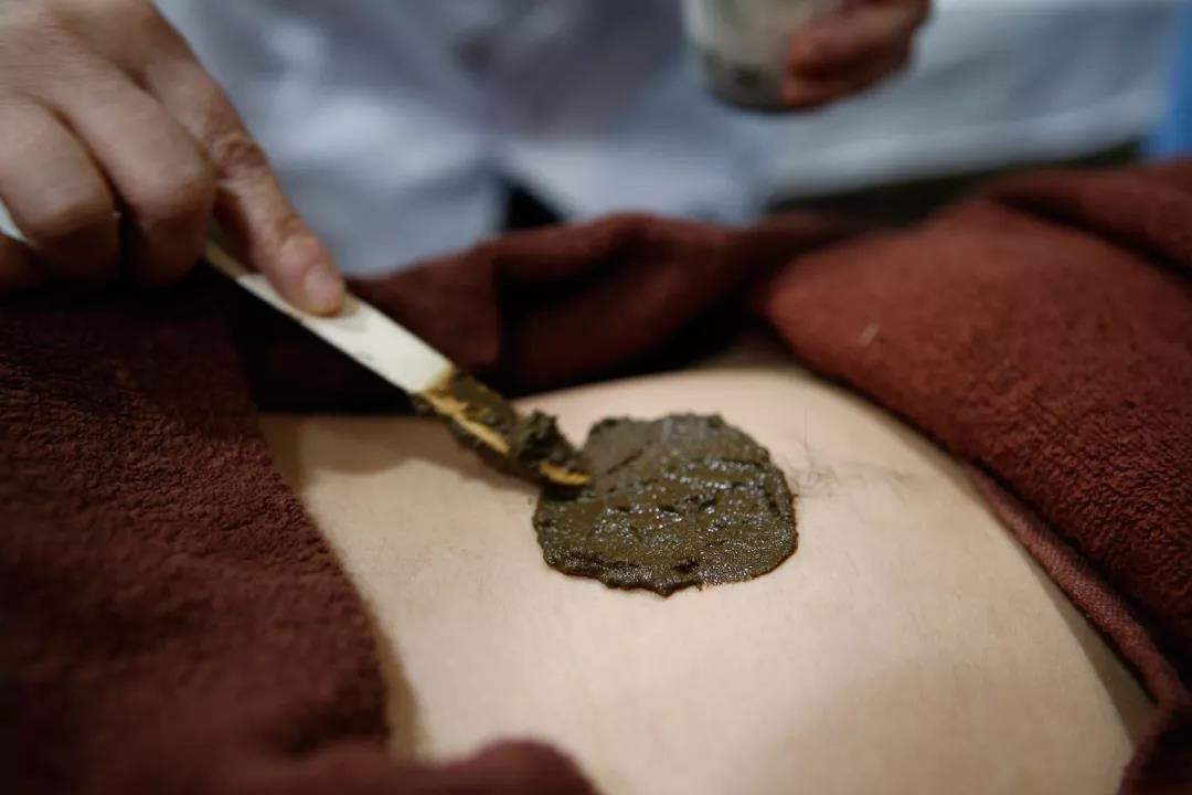 腧穴分为几大类,腧穴的分类和区别