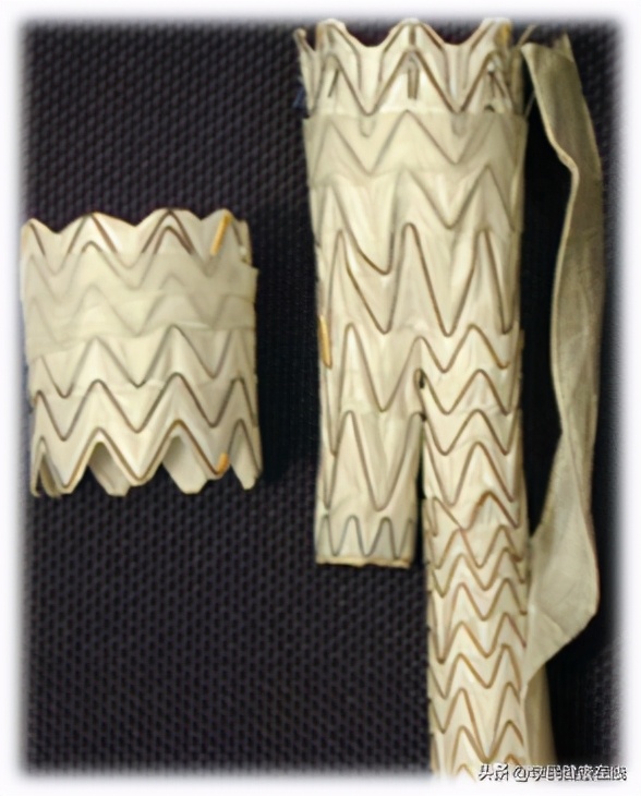 腹主动脉瘤术后内瘘怎么办,腹主动脉瘤出现内瘘解决办法