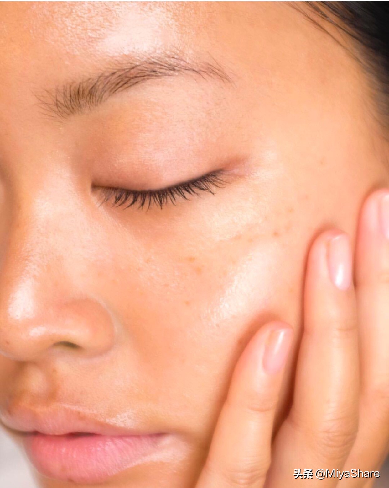 护肤品过敏爆痘了怎么办,护肤品过敏起痘怎么治好