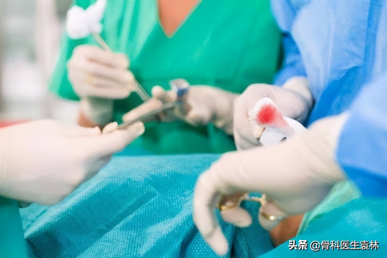 膝盖骨质增生的治疗方法中医,膝盖骨质增生怎么治疗效果最佳