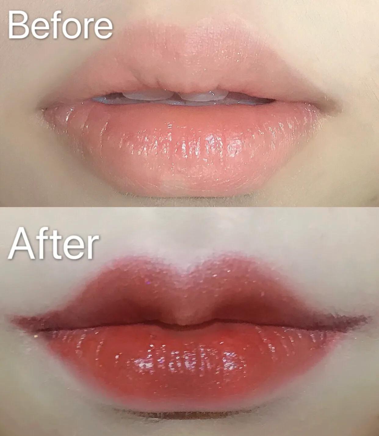 侧颜凸嘴怎么修,让侧脸变好看的方法