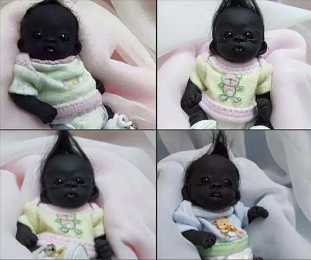 5年前，早产出生的非洲婴儿因皮肤太黑红遍网络，如今变成怎样了