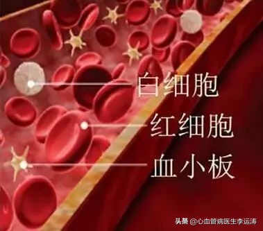 病人血小板低该吃什么药防治心梗,预防心梗复发阿司匹林用量