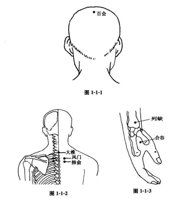 艾灸治疗感冒的正确方法,艾灸治疗感冒咳嗽视频