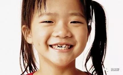 小孩子换牙怎么那么丑,为什么换牙期的宝宝丑