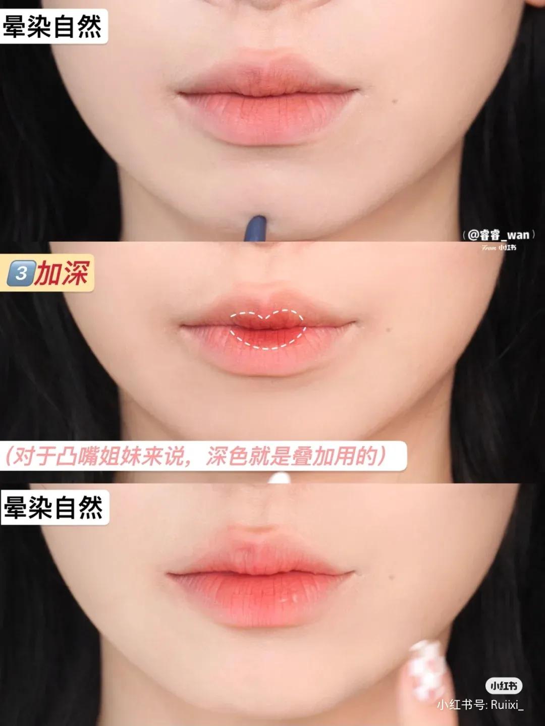 凸嘴怎么自己改善视频,纠正凸嘴后的对比照片