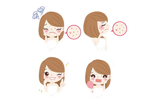 祛痘印和淡化痘印的区别,祛痘印和痘坑有什么区别