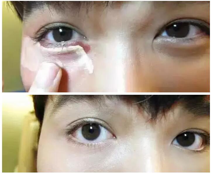 选择什么遮瑕可以遮住黑眼袋,男士遮瑕遮眼袋用什么好