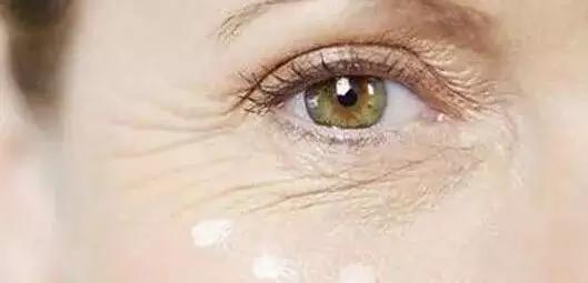 动态纹会变成静态纹,静态纹和动态纹哪个容易去掉