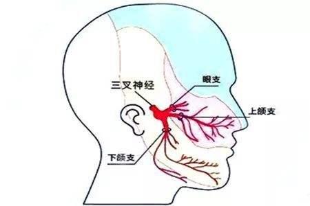 牙痛真的不是一般的痛,牙痛不是病自己才知道