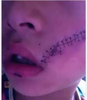 男孩喝碳酸饮料瓶爆炸,一小孩被喷泉水柱冲起