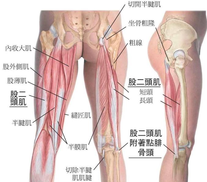 膝超伸腿粗运动可以改善吗,大粗腿膝超伸矫正方法图解