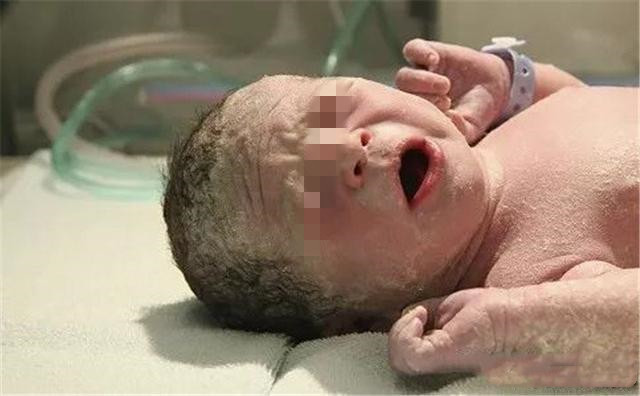 新生儿出生时屁股为啥青,孩子出生为啥屁股一大片淤青