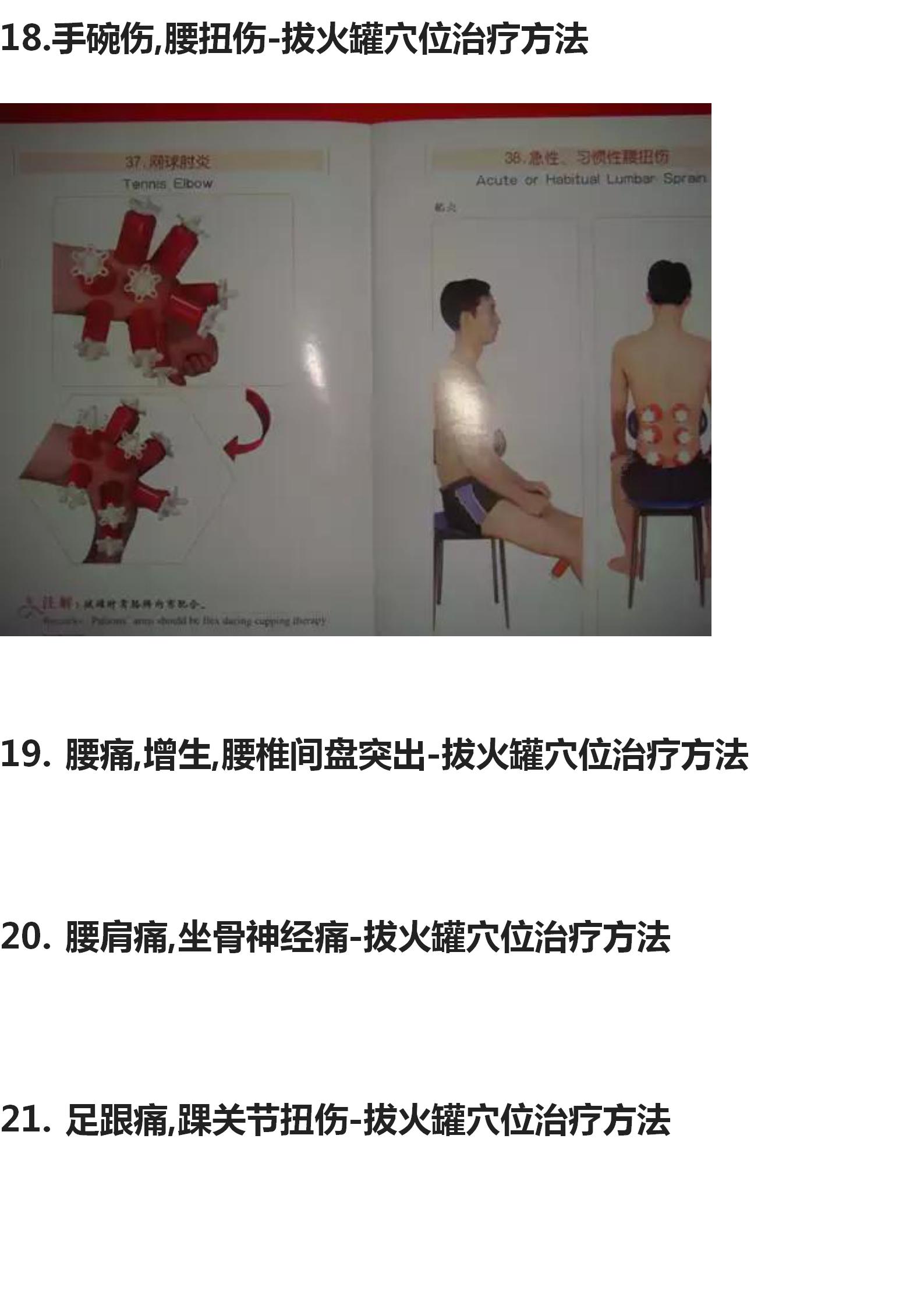 拔罐的手法和穴位图,中医拔罐穴位图片及作用