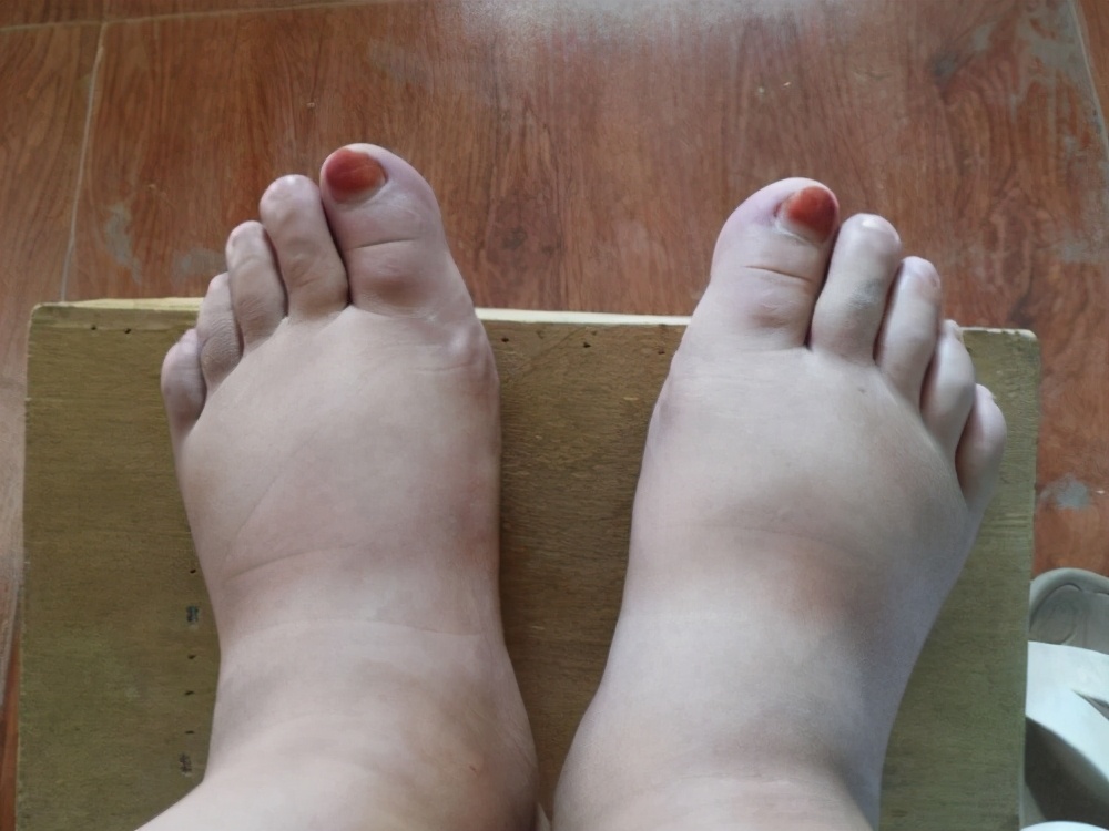 准妈妈孕晚期,准妈妈孕晚期的健康问题