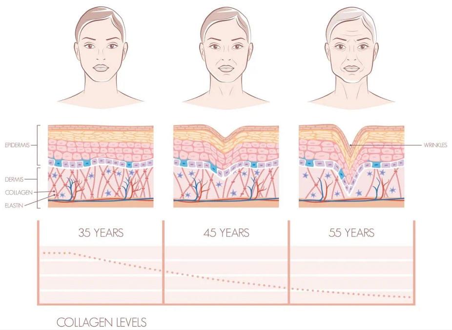 热拉提2.0好还是热玛吉好,热拉提跟热玛吉哪个性价比高