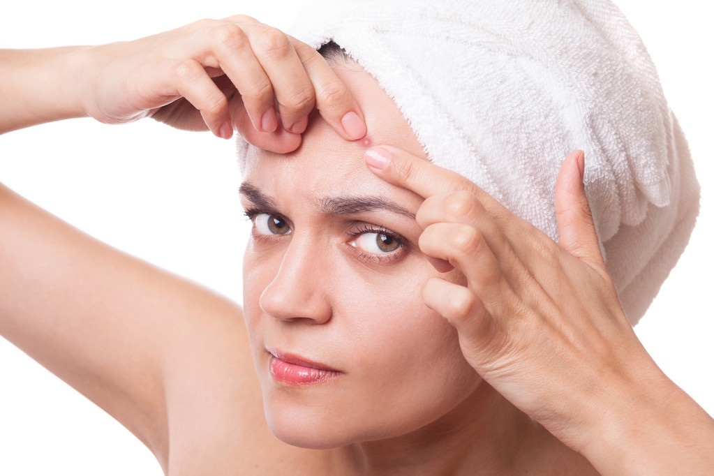 痘印黑头怎么去除小妙招,去除黑头痘印药膏