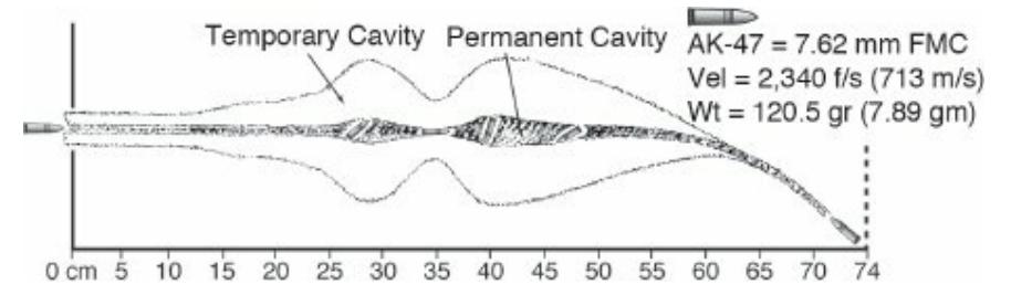 战伤救治常用技术病例分析题,战伤外科处理