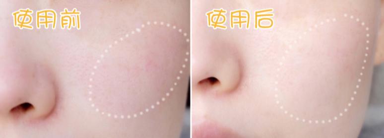 韩国明星都在用的面霜,黑皮韩国明星