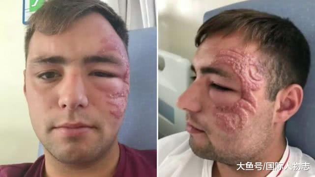 海娜纹身有害吗,海娜纹身有危害吗