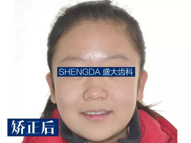 山西“爱马仕”级别齿科医院!get明星同款笑容