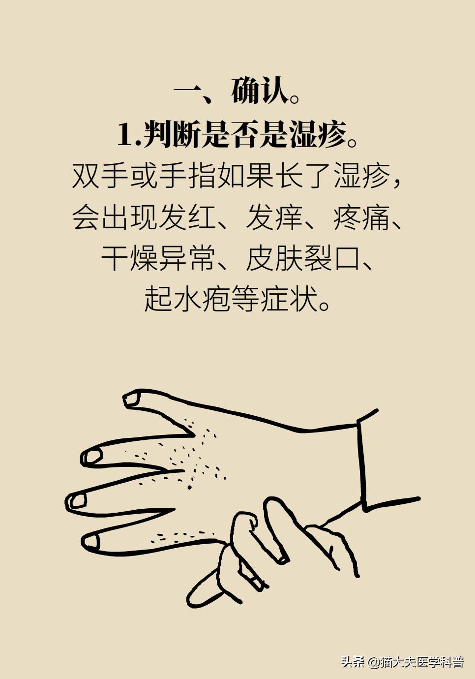 手上长湿疹起皮皲裂怎么治,手上长湿疹有小水泡痒怎么治