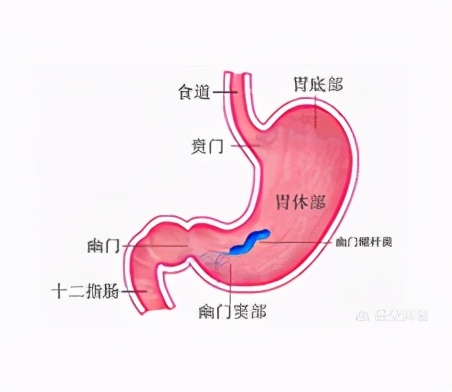 幽门螺杆菌治好后再次感染的几率,一人感染螺旋杆菌全家治疗