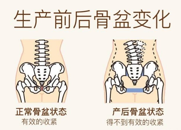 顺产后对产妇身体产生些什么影响？